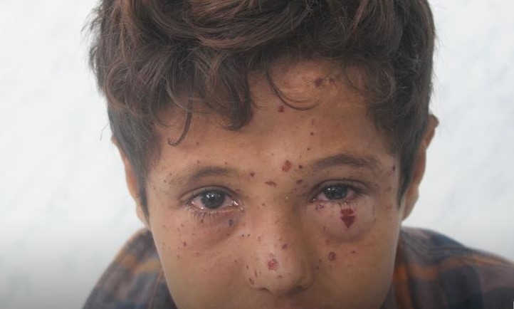اليمن.. مقتل وإصابة 14 مدنيا بالألغام ومخلفات الحرب خلال 48 ساعة