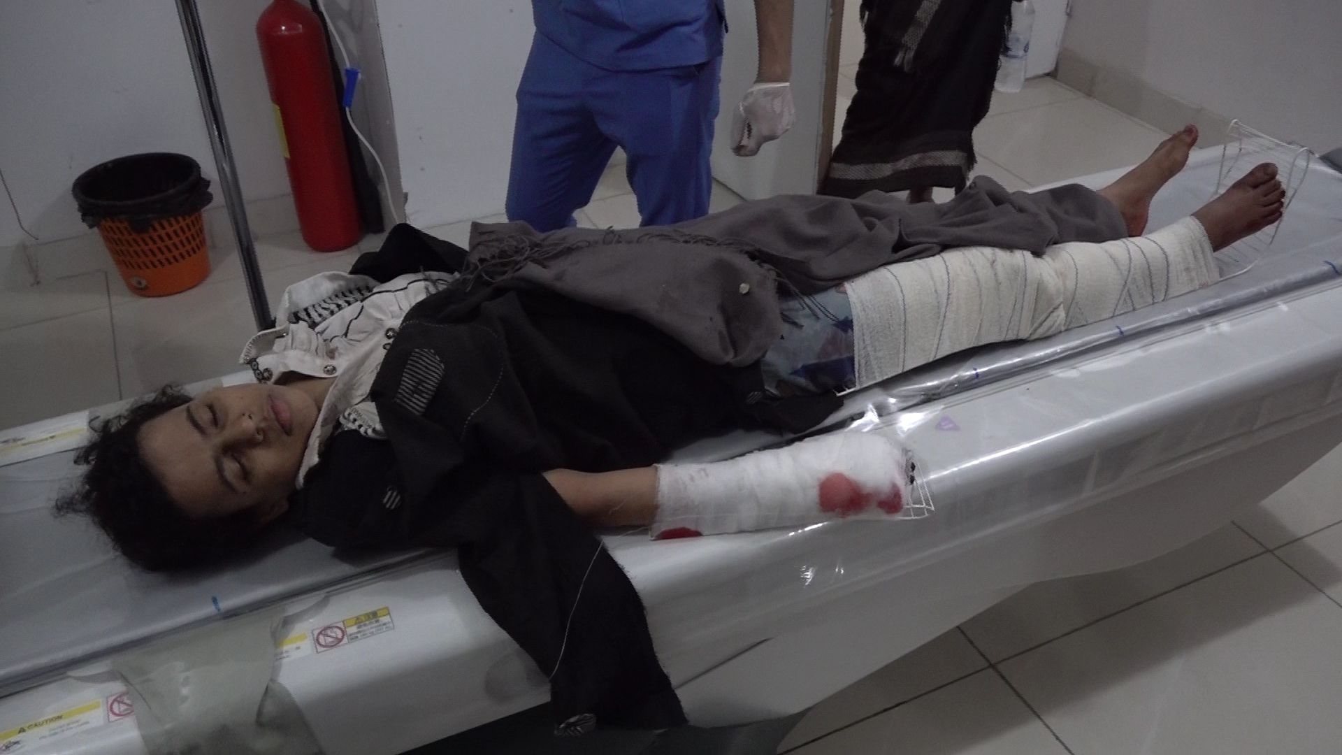 إصابة ثلاثة أطفال أشقاء جراء سقوط قذيفة حوثية في حوش منزلهم غربي تعز