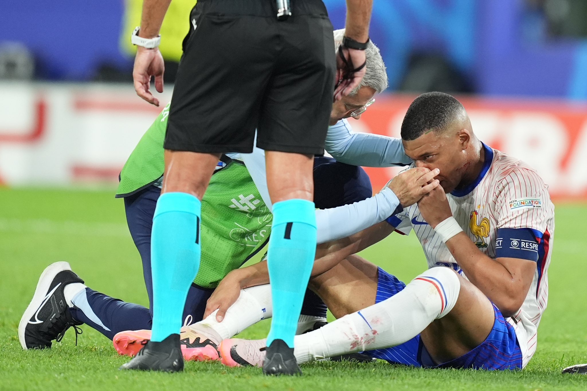 هل يغيب مبابي عن مباريات فرنسا في بطولة 2024؟